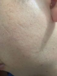 -蕾特恩专业祛痘·皮肤管理