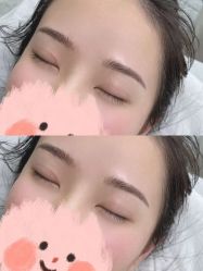 点击看大图 -Verywang半永久纹眉•仪器野生眉