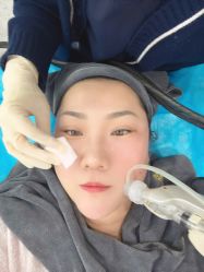 -More摩尔医美の注射线雕光电中心