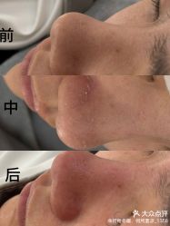 -SKIN79皮肤管理中心