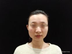 体验后-北京楚诺医疗美容