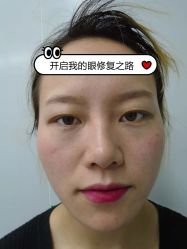 -素美医疗美容·西南眼鼻整形·修复基地