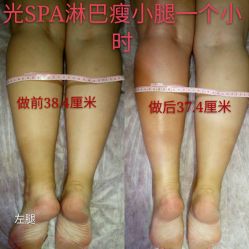 -光SPA科技美肤
