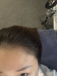 -章光101防脱养发荟