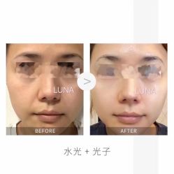 -LUNA皮相美·骨相美高级美感