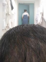 点击看大图 -大麦微针植发丨全国连锁