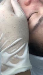 -元熙兰积皮肤管理