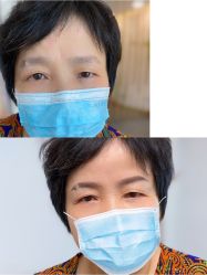 -Doris多里斯半永久纹眉·SMP纹发·发际线