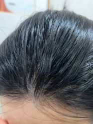 -熙朵美学植发·连锁品牌