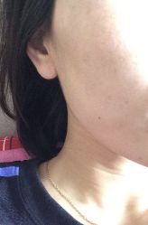 -南宁维密整形·王敦华眼鼻整复中心