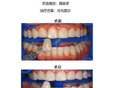 -团圆口腔·种植中心(锦江院区)