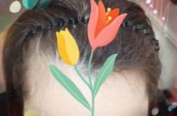 -大麦微针植发全国连锁