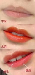 点击看大图 -西施无菌半永久纹绣眉眼影唇轻增发纹发际线
