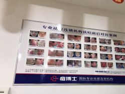 -痘博士重庆·全国连锁祛痘机构