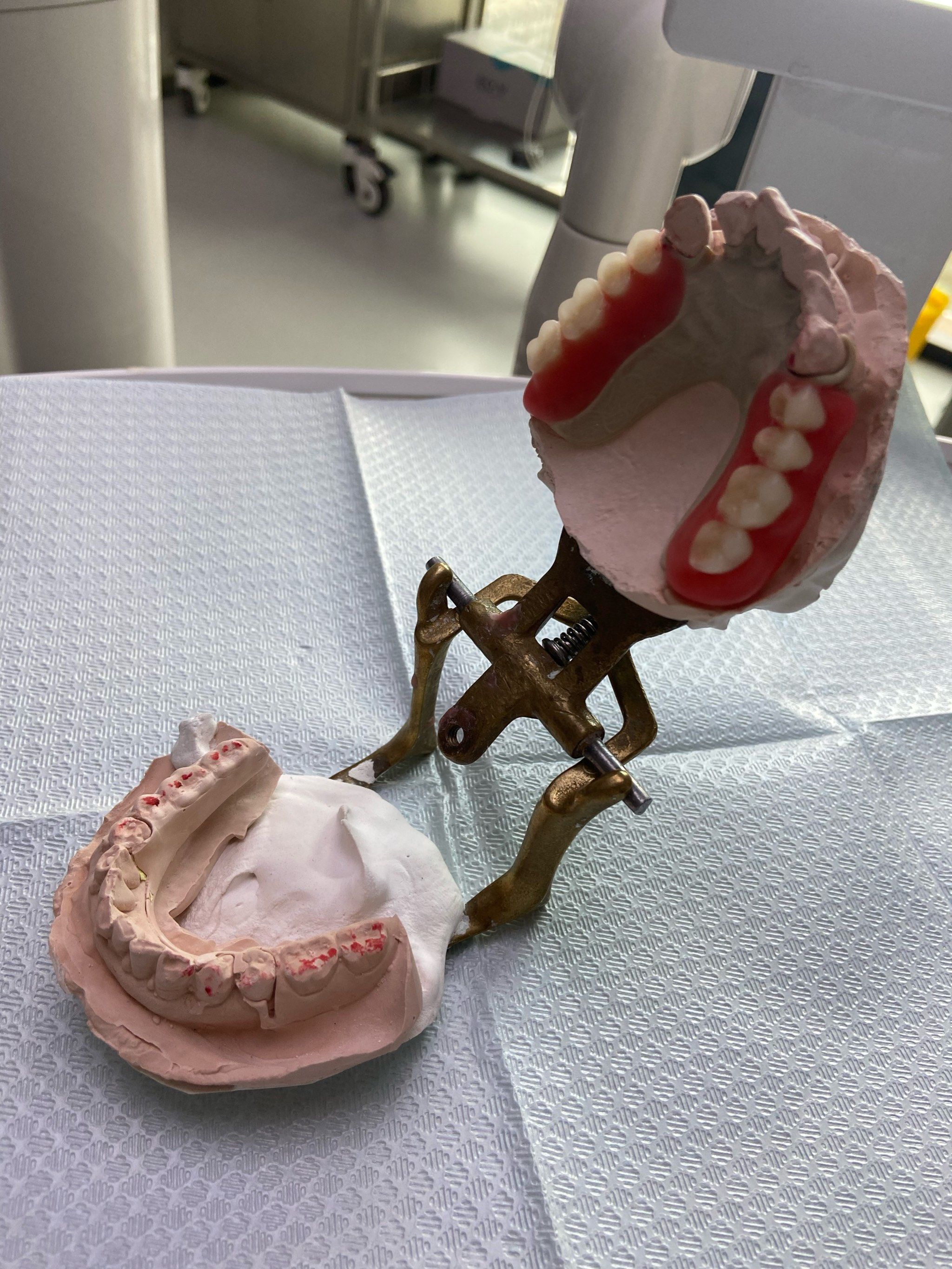 轻巧舒适的peek支架活动牙来啦