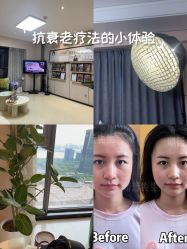 -颜和骨正&明星徒手小颜整骨