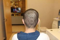 -大麦微针植发丨全国连锁