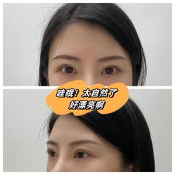 -素美医疗美容·西南眼鼻整形·修复基地