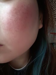 -agge蛋白医美