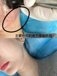 点击看大图 -南京康美美容医院·旗舰店