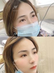 -西施无菌半永久纹绣眉眼影唇轻增发纹发际线