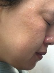 -长沙雅美医疗美容医院
