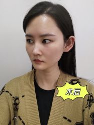 -天津伊美尔医疗整形美容专科医院