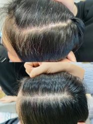 点击看大图 -诗碧曼养发