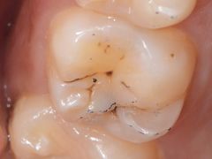 -新达口腔(华东理工大学店)