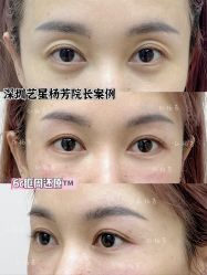 -深圳艺星医疗美容医院