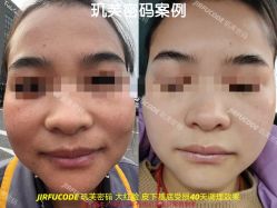 -元熙兰积皮肤管理