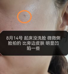 -正璞医疗美容·皮肤修复·微整注射