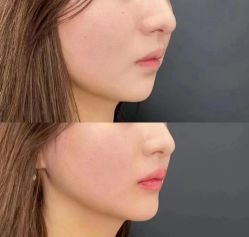 -南宁维密整形·王敦华眼鼻整复中心