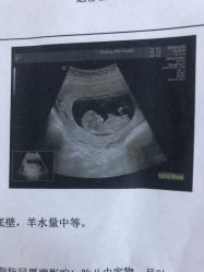 -北京妇产医院(东院)