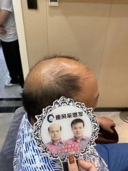 -唐风采假发补发定制