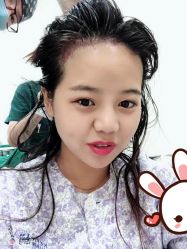 -大麦微针植发丨全国连锁