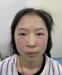 -天津健丽·去眼袋医疗美容机构