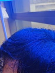 -碧莲盛·不剃发植发