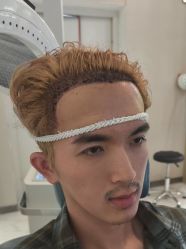 -大麦微针植发丨全国连锁