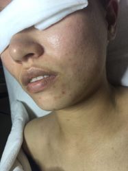 -皇族养心堂·净痘·修敏·御颜