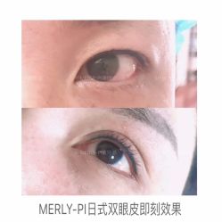 -MLP美丽派·问题肌疗愈中心