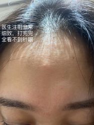 体验后-Yestar艺星医疗美容医院