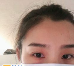 体验前-坤如玛丽·医疗美容中心