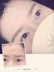 -久匠半永久纹眉