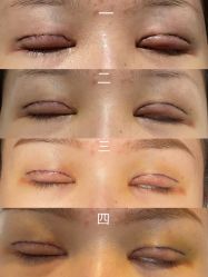 点击看大图 -海峡医疗美容医院