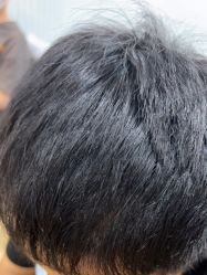 -熙朵美学植发·连锁品牌