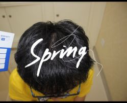 点击看大图 -大麦微针植发全国连锁