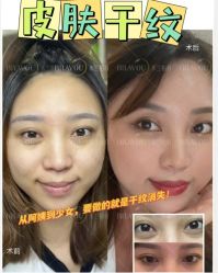 -深圳米兰柏羽医疗美容医院