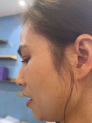 -长沙雅美医疗美容医院