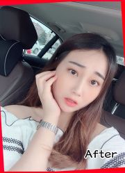 -小忠丽格医美